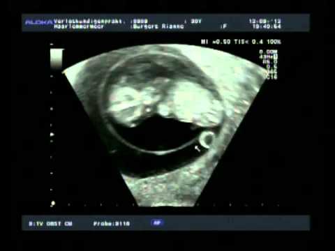 Baby Rietvelds eerste film!