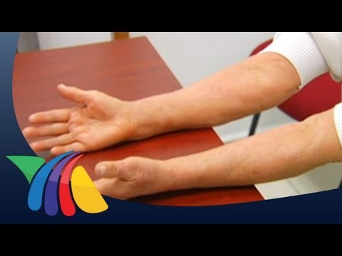 Cura di psoriasi di artropatichesky Mustela per bambini a dermatite atopic il prezzo