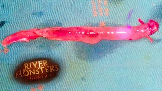 Download lagu Removing A Candiru From Man's Penis | HORROR STORY | River Monsters mp3