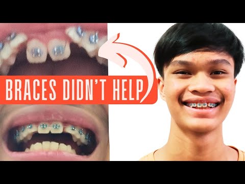 Witness21  2024 02 29