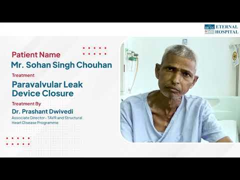 Patient Testimonial of a Paravalvular Leak Patient - Dr. Prashant Dwivedi