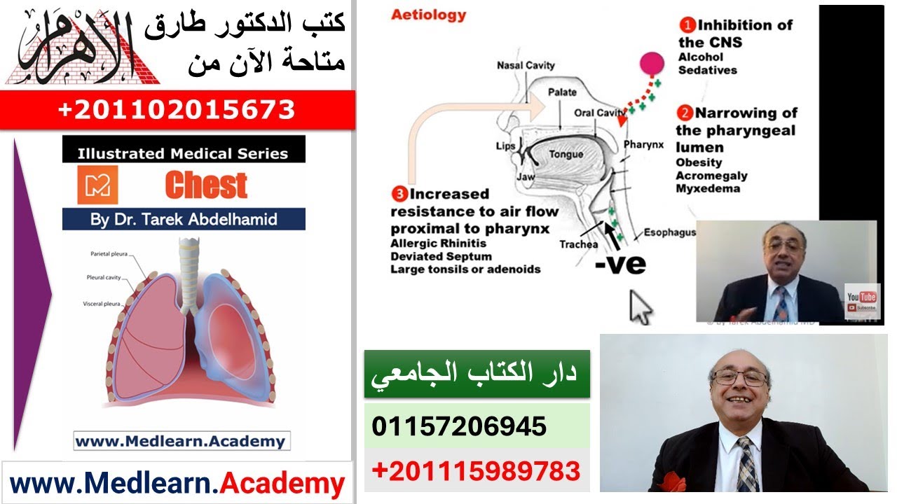 Sleep Apnea Syndrome   #cme #internal_medicine #medical #usmle #محاضرات_باطنة