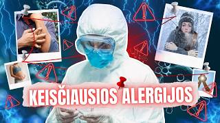 Keisčiausios alergijos pasaulyje: kai alergizuoja net nėštumas ar telefonas
