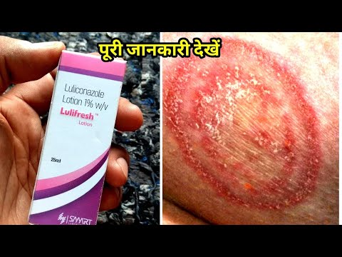 Lulifresh lotion 25ml, strength: 1% w/v