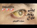 Surah E Quresh Se Hepatitis Piliye Ka Rohani Ilaj Hepatitis Piliya