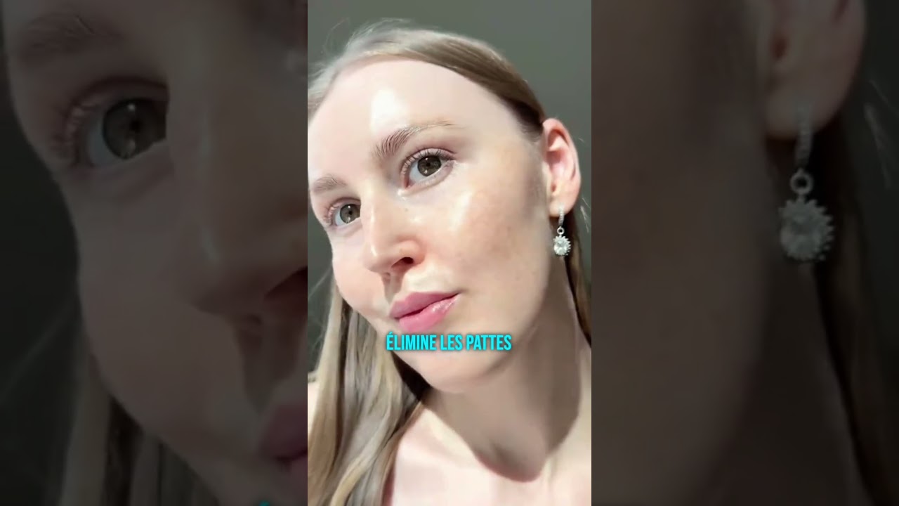 The Brazilian Miracle Serum: Look 10 Years Younger Naturally Without Injections #MiracleSerum