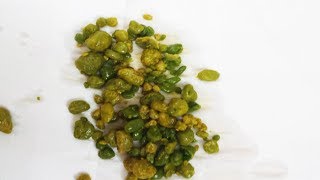 This Can Flush Hundreds Of Gallstones, Making Your Liver Function 10 Times Better