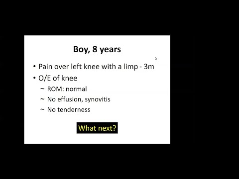 CASE 103 - INTERACTIVE CASE DISCUSSUON - PERTHES DISEASE - DR. DHIREN GANJWALA AND DR. HITESH SHAH