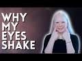 Shaking Eyes - My Nystagmus + Coping Tips/Tricks