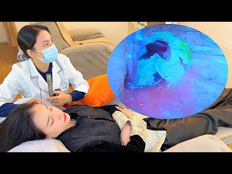 Korean Ear Cleaner