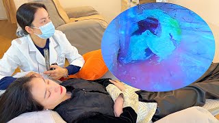 🔍Microscope-Level Visual Ear Cleaning ASMR! Full Footage of Ear Canal SPA Cleaning!
