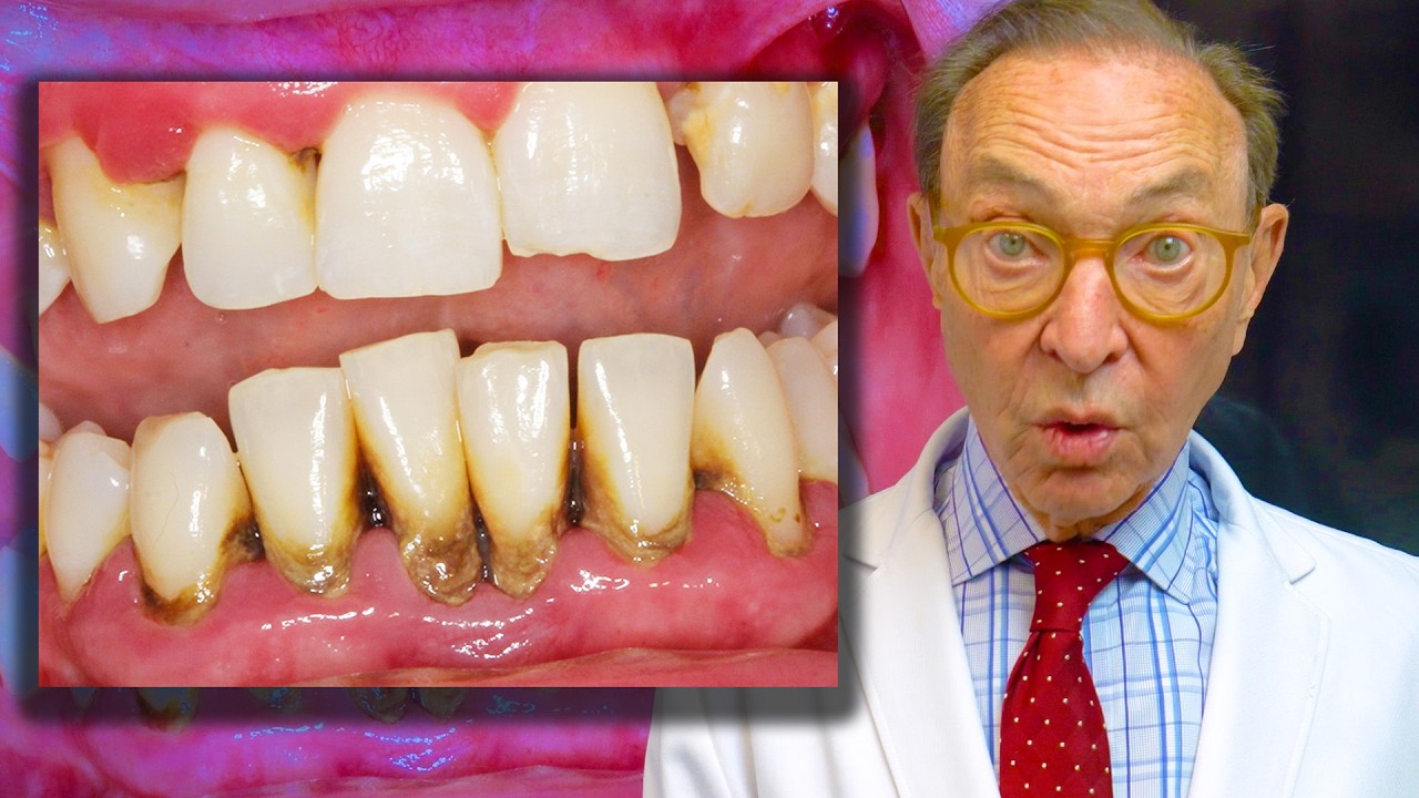 LANAP vs. Pinhole: Why You Might Need BOTH for Healthy Gums!