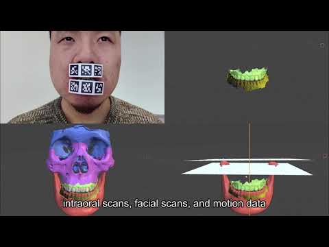 CT Edition -AI Intelligent Electronic Facebow