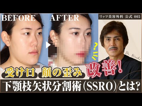 顎の骨について詳しく解説