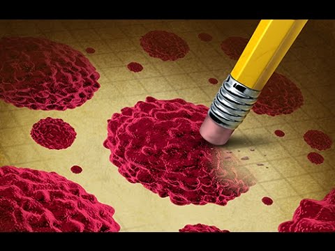 comment guerir cancer de la peau