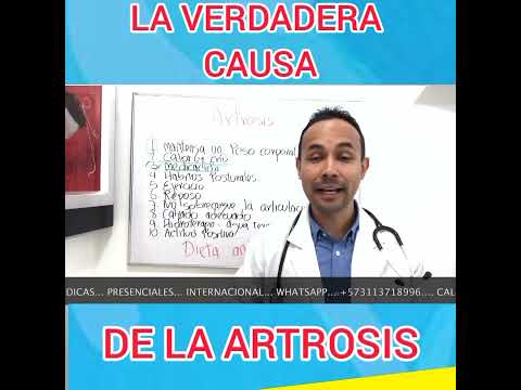 La verdad sobre la artrosis