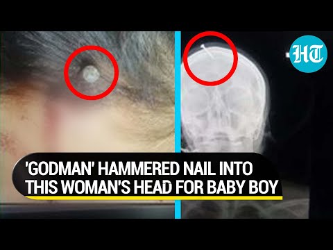 Pakistan shocker: Nail driven into pregnant woman's head; Faith healer assured her a baby boy