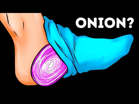 I Slept With An Onion In My Sock And This Is What Happened