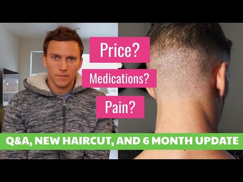 Hair Transplant Q&A, 6 month update, and new haircut!...