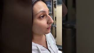 Scarless Nose™️ Rhinoplasty 1 year postop! 7 day rapid recovery and ca