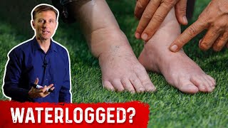 Fluid Retention On Keto Diet? - Dr. Berg