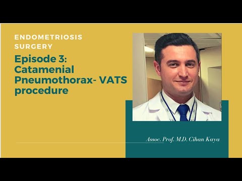 Catamenial Pneumothorax