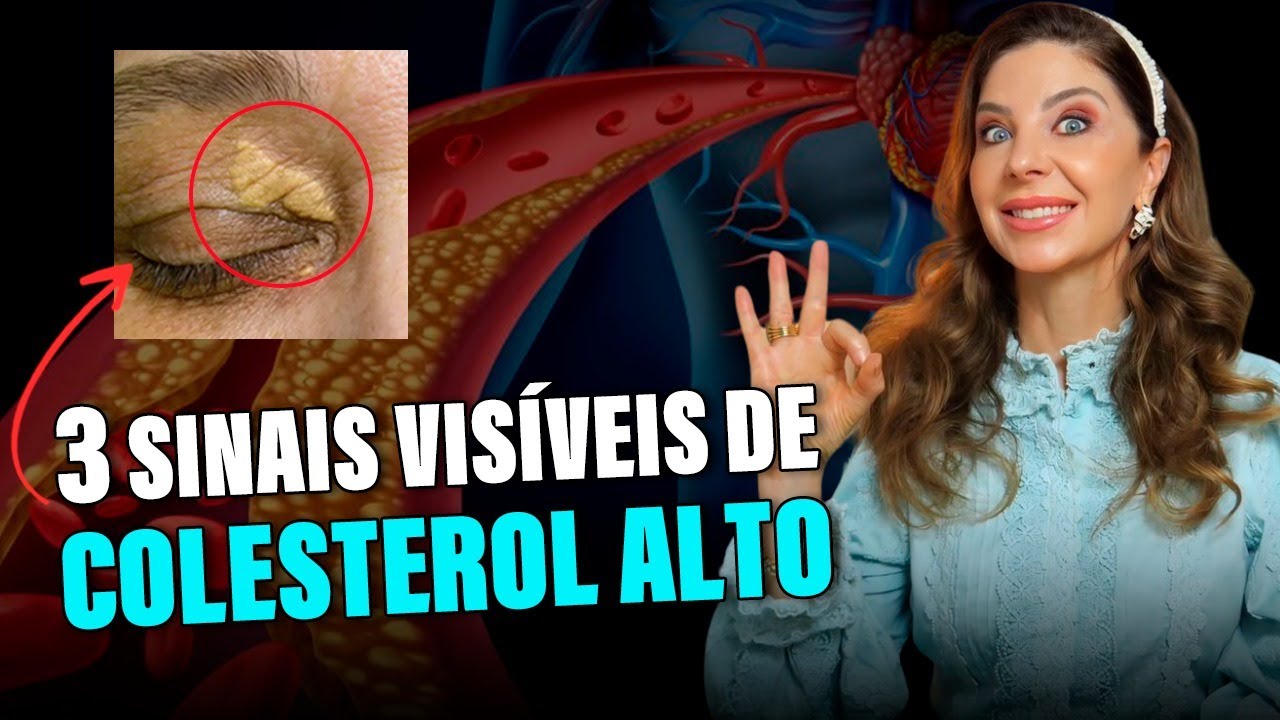 3 Sinais Visíveis de Colesterol Alto