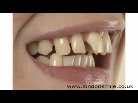 download lagu mp3 mp4 Smile Dental Surgery, download lagu Smile Dental Surgery gratis, unduh video klip Smile Dental Surgery