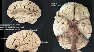 Lateral sulcus