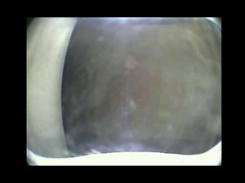 Riser Caisson Inspection (through inspection riser) using RD-60 pipeline camera