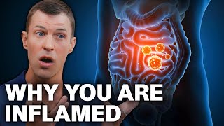Top 9 Root Causes of Inflammation (That Doctors Won’t Address)