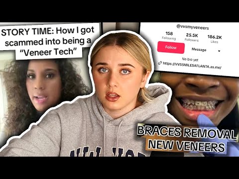 VENEER TECH BOSS-BABES FINALLY GETTING SUED!