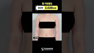 팔라인 달라지니까 상체까지 예뻐보이잖아😍