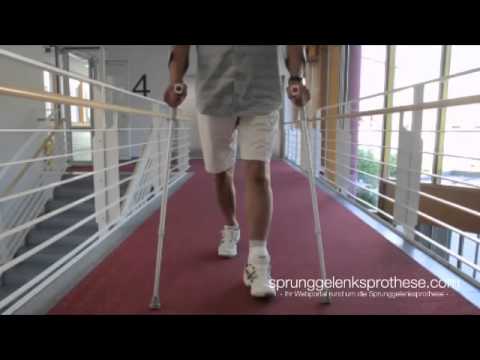 Physiotherapie auf die Knie- und Hüftgelenke Wehen beginnen von Rückenschmerzen