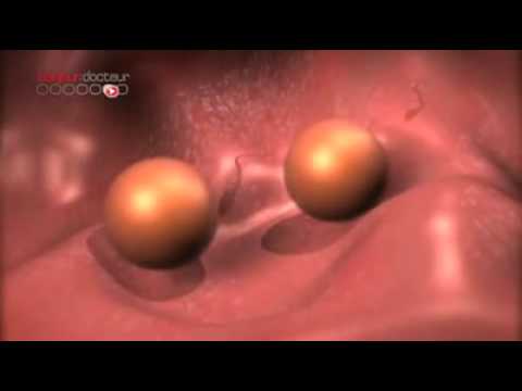 Comment se forment les jumeaux