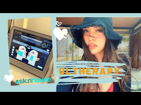 Ulthera in your 20s, is it worth it?