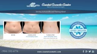 preview picture of video 'CoolSculpting now being offered at Coastal Cosmetic Center'