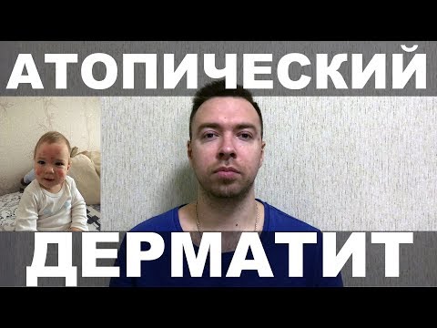 АТОПИЧЕСКИЙ ДЕРМАТИТ у детей. Как за МЕСЯЦ его вылечить у ребенка. ЛЕЧЕНИЕ наш опыт ПОШАГОВО.
