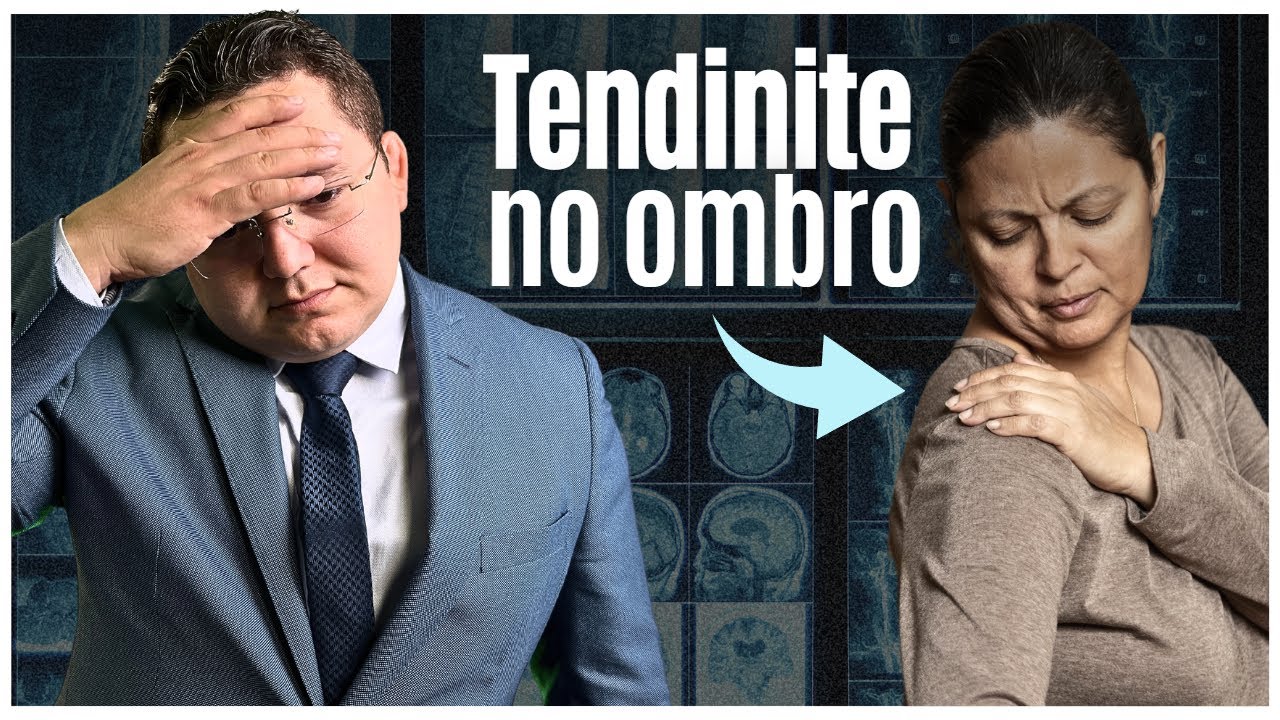 Direitos e causas de tendinopatias no ombro pelo Trabalho! SAIBA aqui…