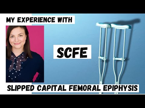 My Experience with SCFE (Slipped Capital Femoral Epiphysis)