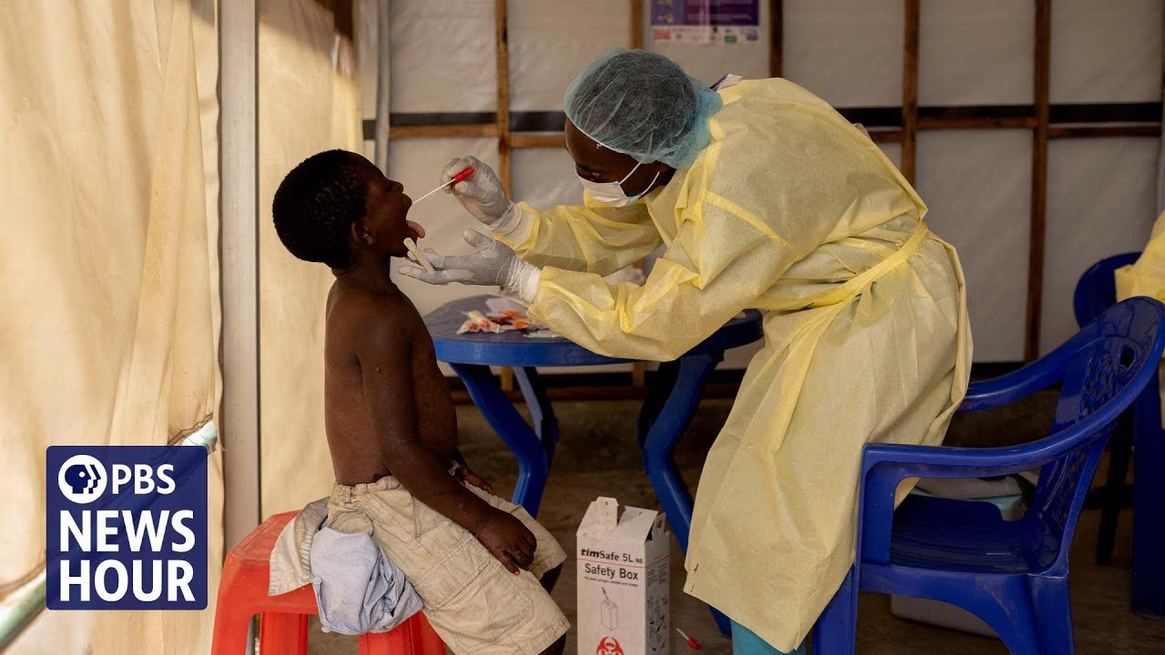 Epidemiologist breaks down how and where mpox is spreading