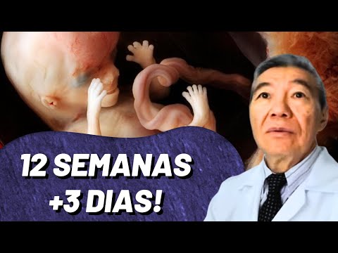 PREGNANCY 12 WEEKS + 3 DAYS! PLAYFUL BABY