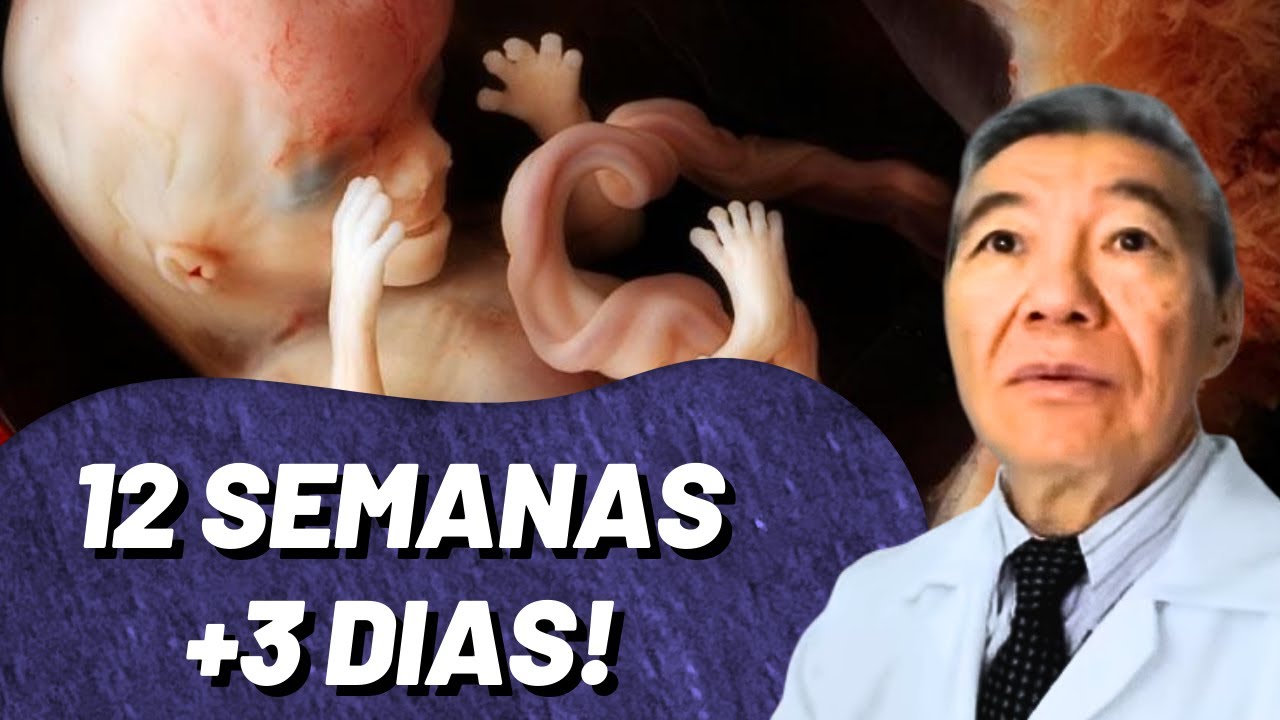 GESTAÇÃO 12 SEMANAS + 3 DIAS! BEBÊ BRINCALHÃO