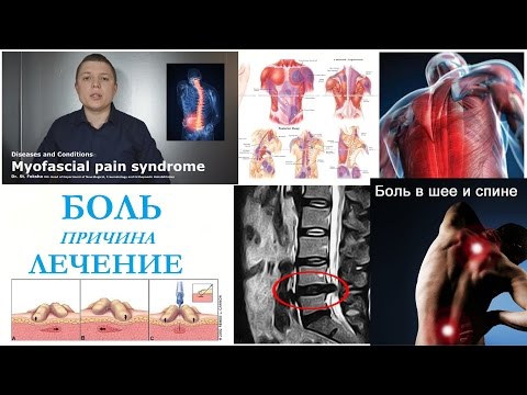 Ломит суставы глаза слезятся Болит бок с правой стороны со спины по утрам