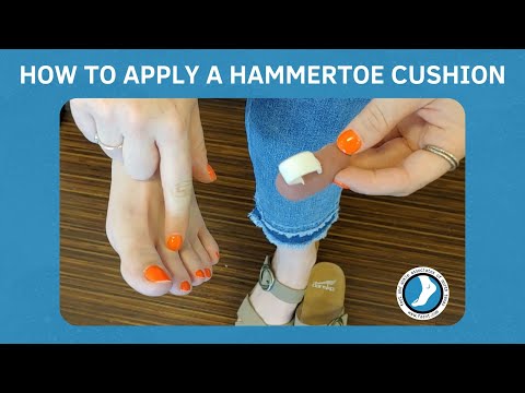 How to Use a Hammertoe Cushion