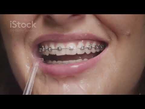 Peak advertising waterflosser!!!