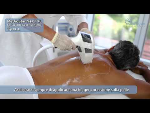 Mal di schiena dopo aver bevuto cosa fare Cosa fare se le articolazioni scricchiolio delle mani e dei piedi