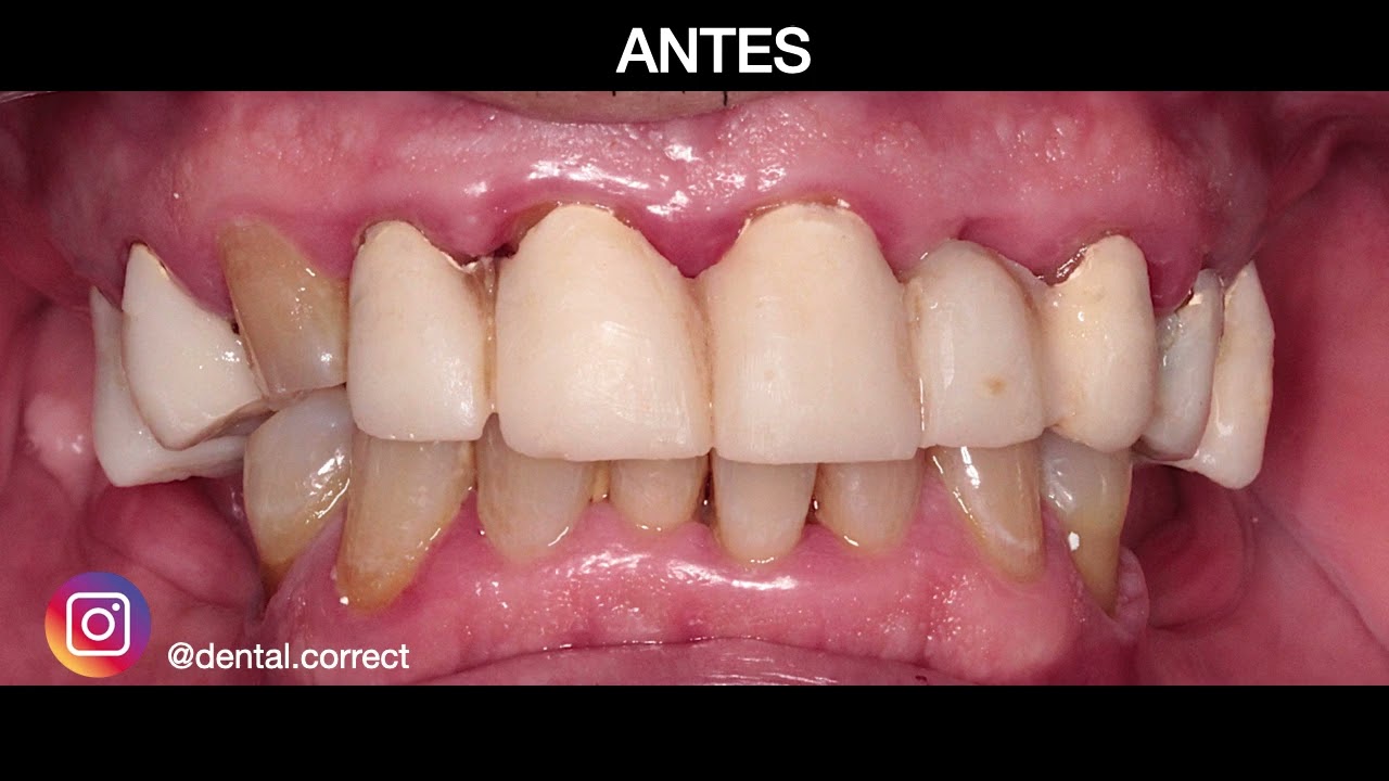 Aide Montserrat Orozco Gutierrez-57