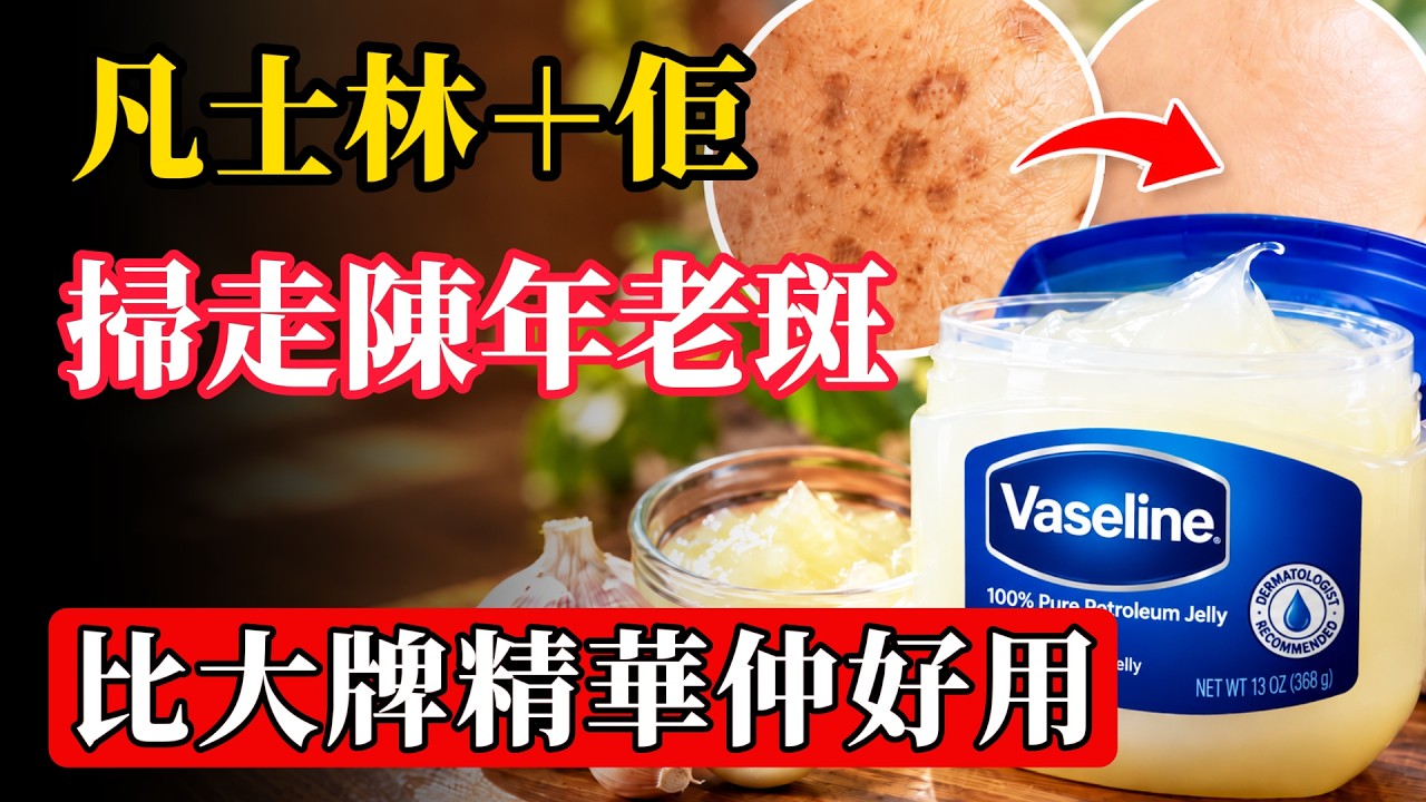 凡士林＋「佢」，掃走陳年老斑，比大牌精華仲好用！#老人斑 #老年斑 #凡士林 #維他命E #维生素E #凡士林去斑 #淡斑 #色斑