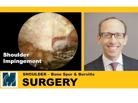 Ibuprofen Schmerzen in Osteochondrose Wie lange Osteochondrose
